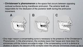 Complete Dentures 1  10 Lower Anterior Setup amp Occlusal Schemes [upl. by Felicity535]