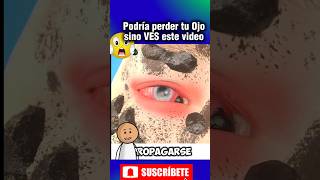 😱¿Qué podría pasar wow salud datoscuriosos ojos curiosidades shorts shortsviral shortsfeed [upl. by Oiragelo]