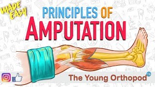 Amputation Principles  ANIMATION  BASICS  NEET PG  Amputee  The Young Orthopod [upl. by Thorrlow]