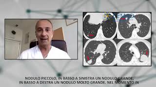 Approccio Diagnostico ai Noduli Polmonari [upl. by Niac544]