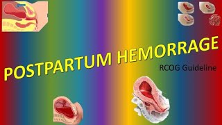 Postpartum Haemorrhage PPH RCOG Guideline [upl. by Myrvyn]