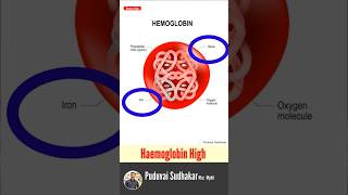 High Hemoglobin  🩸 hemoglobin hb அதிகபட்ச ஹீமோகுளோபின் என்ன  🩸❤️‼️ [upl. by Ahsaelat]