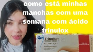 como estão minhas manchas com uma semana do ácido trinulox [upl. by Emmer254]