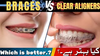 Braces Vs invisible Aligners  which is best  In UrduHindi drmuneermalik [upl. by Mazur]