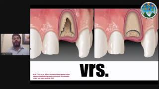 D3S1C3 quotPreservación Alveolar y Regeneración Ósea Guiada Previo a la Implantaciónquot Dr Jorge Sánchez [upl. by Hailey840]