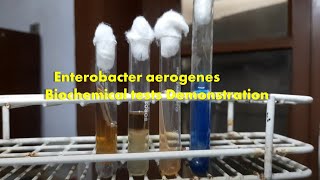 Enterobacter aerogenes Biochemical tests Demonstration [upl. by Yrak]