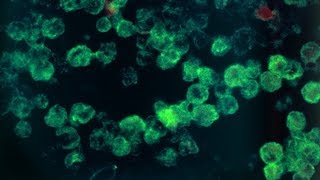 BrainEating Amoebas in Water Kill 10 in Pakistan [upl. by Cynarra324]