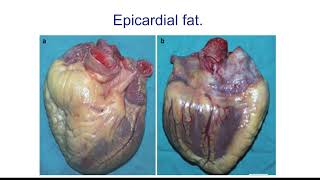 CARDIOVASCULAR PART TWO THE HEART episode 2 [upl. by Dleifyar]