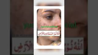 Chehre per pimple dur karne ka wazifa [upl. by Randy]