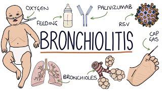 Understanding Bronchiolitis [upl. by Ahsyek]