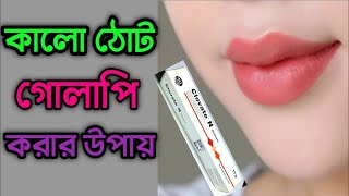 ঠোটের কালো দাগ দূর করার উপায় Tother kalo dag dur korar upay জেনে নিন কালো ঠোট গোলাপি করার ক্রিম [upl. by Anires]