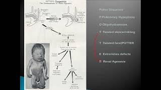 prenatal screening and diagnosis of congenital anomalies [upl. by Arihsan489]