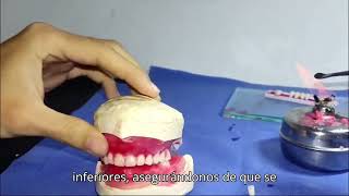 Enfilado dental  Carlos Escorcia  Jennifer Vega [upl. by Ignazio820]