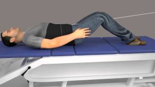 Lumbar Decompression Animation [upl. by Rialcnis]