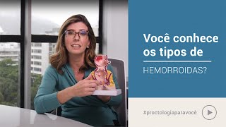 Tipos de hemorroidas e suas classificações  Proctologia para você  Dra Clarisse Casali [upl. by Ty]