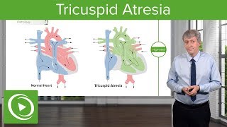 Tricuspid Atresia – Pediatric Cardiology  Lecturio [upl. by Einahpet]