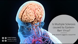 EpsteinBarr Virus EBV causes Multiple Sclerosis MS [upl. by Sandye401]