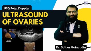 Ultrasound of OVARIES  Practical Scanning Technique by Dr Sultan Moinuddin  Iqramed Academy [upl. by Enomaj]