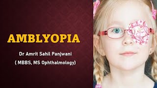 AMBLYOPIA  lazy eye EXPLAINED [upl. by Ilarrold8]