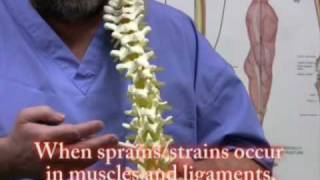 Lower back Pain sports Injuries trauma self treatment [upl. by Erbma]