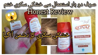 Dandruff Ko Kiya Bye ByeFull Method To Use Conaz Shampoo 🧴skincare conaz dandruff [upl. by Akehsat]