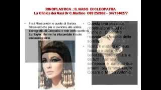 RINOPLASTICA IL NASO DI CLEOPATRA gibboso DR C MARTINO ROMA  NAPOLI SALERNO [upl. by Aed177]