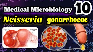 Neisseria gonorrhoeae شرح بالعربي البكتيريا المسببه لمرض السيلان وطرق علاجه [upl. by Charla389]