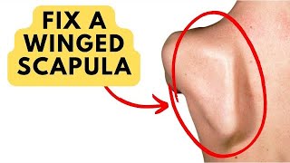 How To Fix A Winged Scapula amp Shoulder Blade the actual root cause [upl. by Patterman]