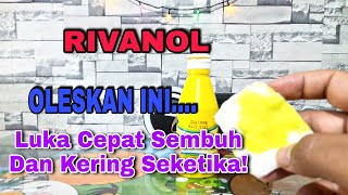 🔥 Cara Ampuh Mengatasi Luka Dengan Rivanol Agar Tidak Infeksi Dan Cepat Kering✅️ [upl. by Uos]