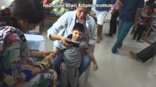 Treatment for Spastic Quadriplegia Cerebral Palsy [upl. by Knapp625]