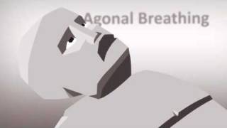 RCUK animation test  agonal breathing [upl. by Eibo450]