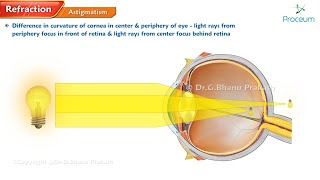 Refractive errors of eye 🌟👁️ Ophthalmology lectures [upl. by Kriss]