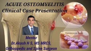 ACUTE OSTEOMYELITIS Clinical case presentation [upl. by Gazo74]