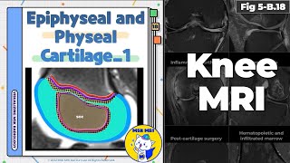 Fig 5B18 Normal Epiphyseal and Physeal Cartilage Part 1 [upl. by Niawtna467]