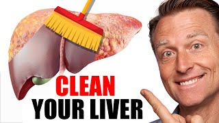 The BEST Foods to Clean Out Your Liver [upl. by Swann]