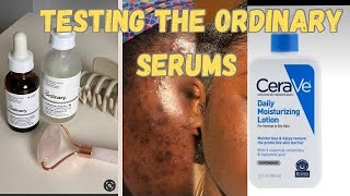 TRYING THE ORDINARY SERUMS ON ACNE PRONE SKIN SKIN CARE NIACINAMIDE [upl. by Ellenig]