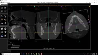 CS 3D Imaging  Reformatting Tool [upl. by Ettennig47]