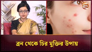 ব্রন থেকে চির মুক্তির উপায়  Dr Jakariya  Acne Removing  Channel 24 [upl. by Kyriako]