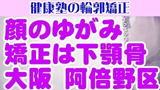 顔のゆがみ 矯正は下顎骨 大阪 阿倍野区 [upl. by Jade]