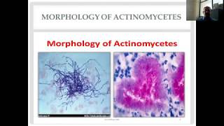 Actinomycetes and Nocardia Diverse Group of Gram Positive Bacilli [upl. by Kcajyllib92]