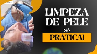 Como Fazer uma Limpeza de Pele  Aprenda Na Prática limpezadepele [upl. by Creigh]