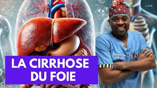 Tout ce que vous devez savoir sur La cirrhose du foie par docteursourire [upl. by Iva]