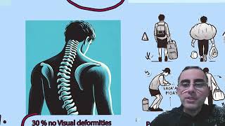 Scoliosis  Signs Symptoms Causes Treatments Myths and Facts [upl. by Eidolem]