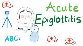 Acute Epiglottitis  Causes Symptoms Diagnosis and Management [upl. by Brody57]