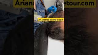 Hair strengthening gun in 🇮🇷 Iranمسدس تقوية الشعر [upl. by Gar]