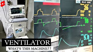 WHAT IS VENTILATOR MACHINE  HOW VENTILATORS WORKS  व्हेंटिलेटर क्या होता है  shorts ventilator [upl. by Sherwynd]