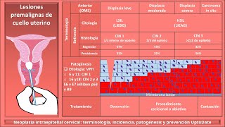 Lesiones premalignas de cervix LSIL HSIL LIEBG LIEAG Neoplasia intraepitelial cervical ENARM [upl. by Rise]