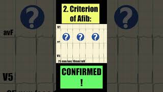 2 simple ECG criteria of ATRIAL FIBRILLATION [upl. by Kowal257]