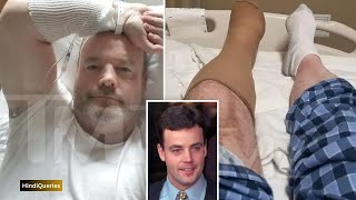 John Wayne Bobbitt Wife Famously Chopped Off His Penis Has Toes Amputated Due to Contaminated Water [upl. by Trimble]