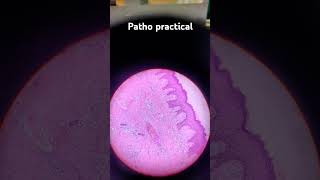 Patho granulation tissue slide 2nd yr mbbs mbbs mbbsmotivation viralvideo [upl. by Haletta612]